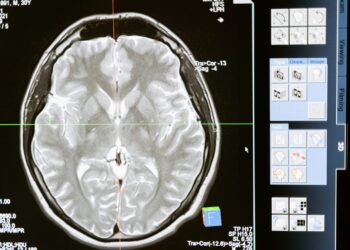Neurologie in Nürnberg: Therapie- und Präventionsmaßnahmen für ein gesundes Gehirn